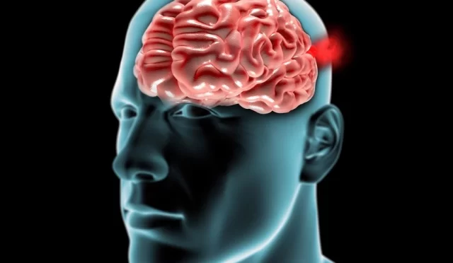 Beyin Anevrizma Ameliyatı Olanların Yorumları